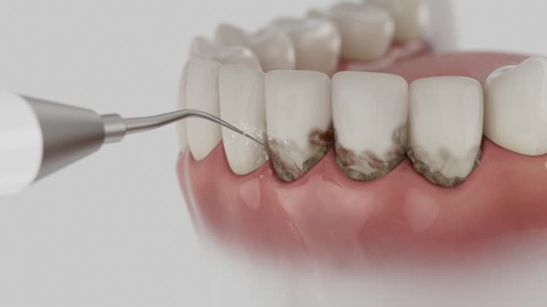 Trusted Teeth Cleaning And Checkup service in Channahon, IL - Dentist Open Now